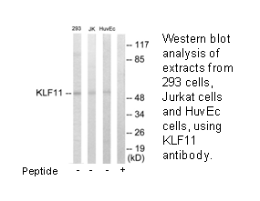 Product image for KLF11 Antibody