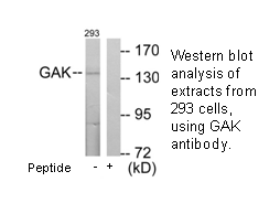 Product image for GAK Antibody
