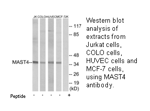 Product image for MAST4 Antibody