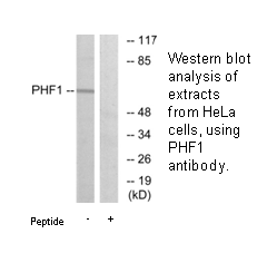 Product image for PHF1 Antibody