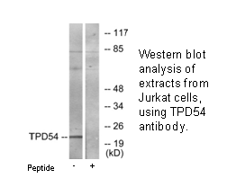 Product image for TPD54 Antibody