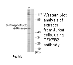 Product image for 6-Phosphofructo-2-Kinase Antibody
