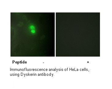 Product image for Dyskerin Antibody