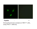 Product image for TACC1 Antibody