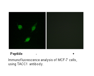 Product image for TACC1 Antibody