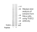 Product image for TUSC2 Antibody