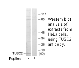 Product image for TUSC2 Antibody