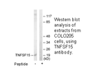 Product image for TNFSF15 Antibody