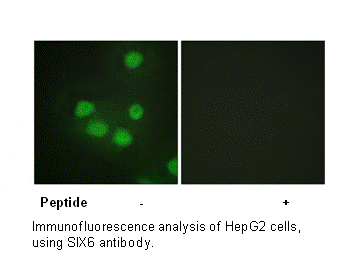 Product image for SIX6 Antibody