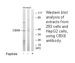 Product image for CBX6 Antibody