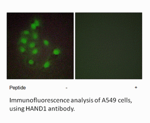 Product image for HAND1 Antibody
