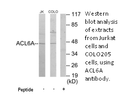 Product image for ACL6A Antibody