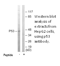 Product image for p53 Antibody