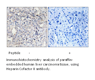 Product image for Heparin Cofactor II Antibody