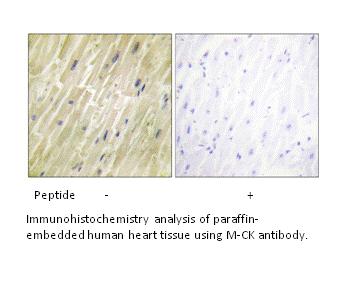 Product image for M-CK Antibody