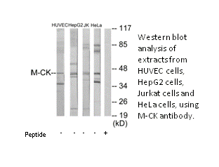 Product image for M-CK Antibody