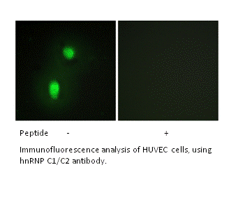 Product image for hnRNP C1/C2 Antibody
