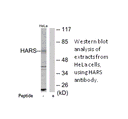 Product image for HARS Antibody