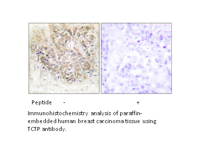 Product image for TCTP Antibody