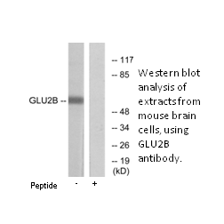 Product image for GLU2B Antibody