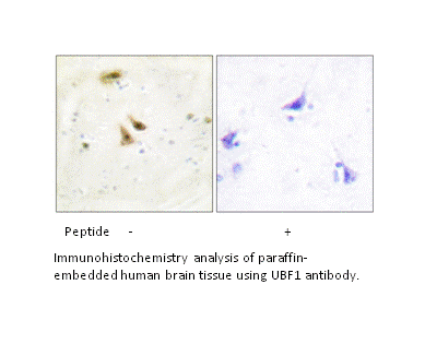 Product image for UBF1 Antibody