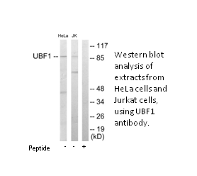 Product image for UBF1 Antibody