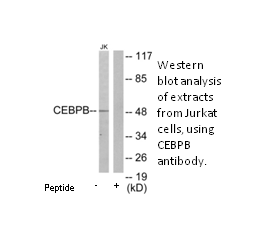 Product image for CEBPB Antibody