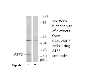 Product image for ATF3 Antibody