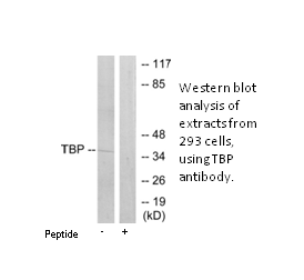 Product image for TBP Antibody