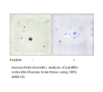 Product image for CRP1 Antibody