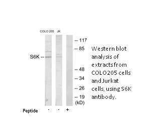 Product image for S6K Antibody