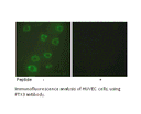Product image for PTX3 Antibody