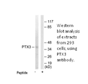 Product image for PTX3 Antibody