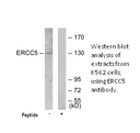 Product image for ERCC5 Antibody