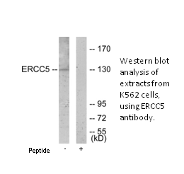 Product image for ERCC5 Antibody
