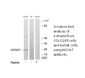 Product image for HOXA7 Antibody