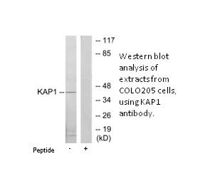 Product image for KAP1 Antibody