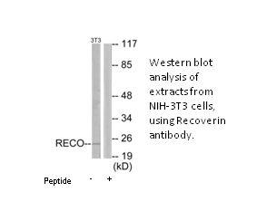 Product image for Recoverin Antibody