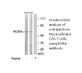 Product image for RORA Antibody