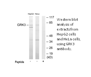 Product image for GRK3 Antibody