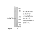 Product image for hnRNP G Antibody