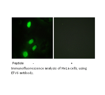 Product image for ETV6 Antibody