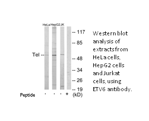 Product image for ETV6 Antibody