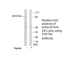 Product image for STAT5A Antibody