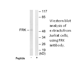 Product image for FRK Antibody