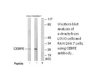 Product image for CEBPD/E Antibody
