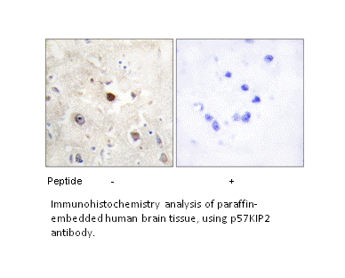 Product image for p57KIP2 Antibody