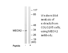 Product image for MEOX2 Antibody