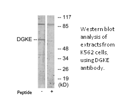Product image for DGKE Antibody