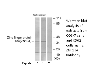 Product image for ZNF134 Antibody